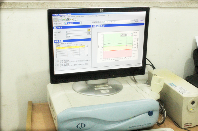 超声骨密度仪